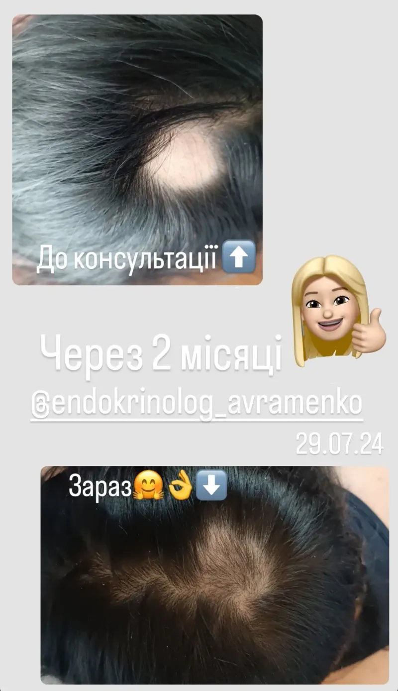 Відгук пацієнта 35
